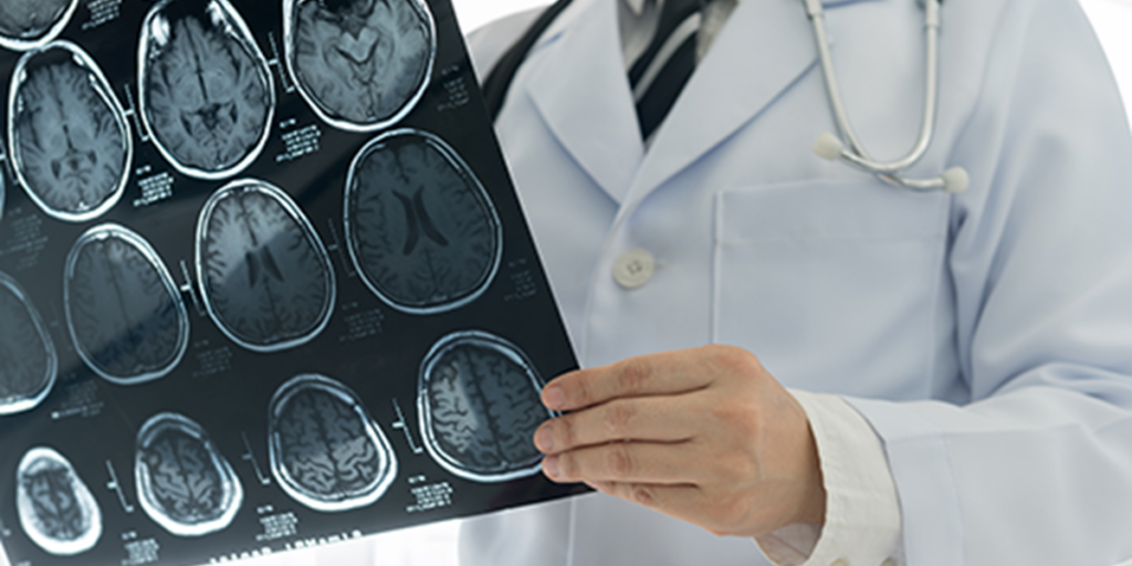 Doctor looking at neuro scans using new technologies.